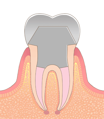美しい歯をホワイトニング