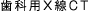 ������X��CT