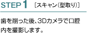 STEP1 スキャン型取り